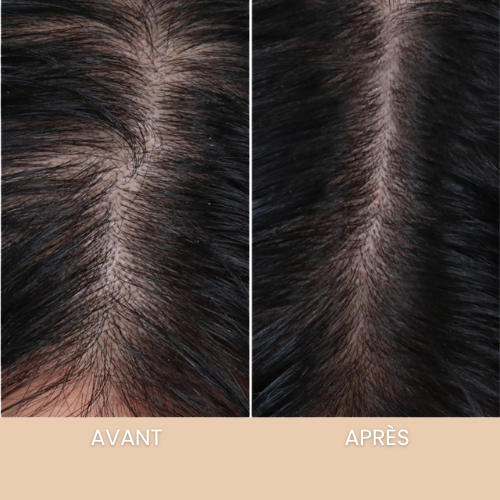 VITALYS - LE SÉRUM ANTI-CHUTE