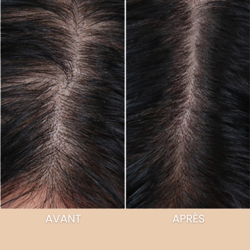 VITALYS - Le sérum qui redonne vie à vos cheveux