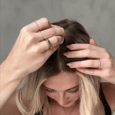 Micro-Infusion Hair Regrowth